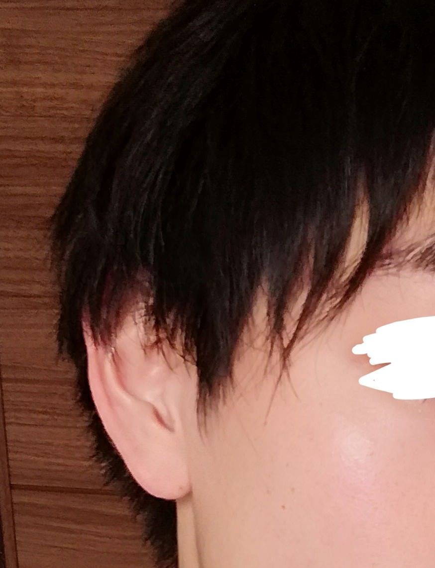 【朗報】スキンケアを極めたワイ、美肌になり女にもてまくる: みじかめっ！なんJ